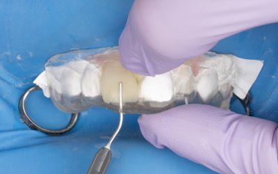 Injection Molding Technique – Dr. Hiromi Saisho