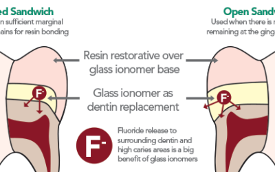 The Sandwich Technique