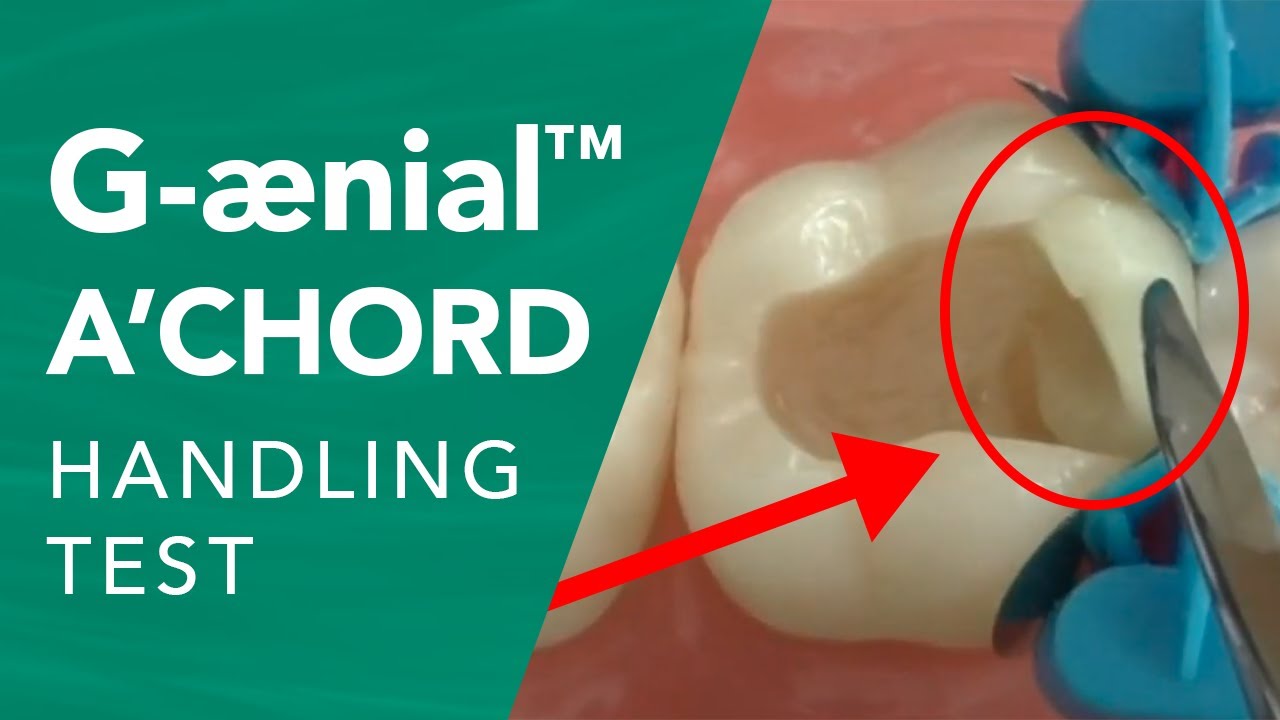 R1KW_GVOvoY-HD G-ænial™ A'CHORD – The Handling Test