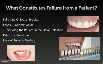 Invisible Anterior Composite Restorations: Esthetics with a Simplified System