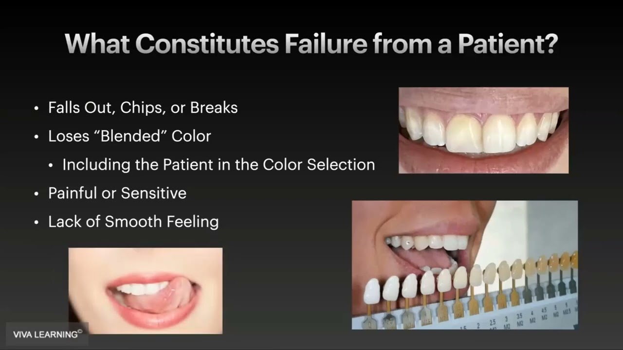 egIAmmIM_oM-HD Invisible Anterior Composite Restorations: Esthetics with a Simplified System