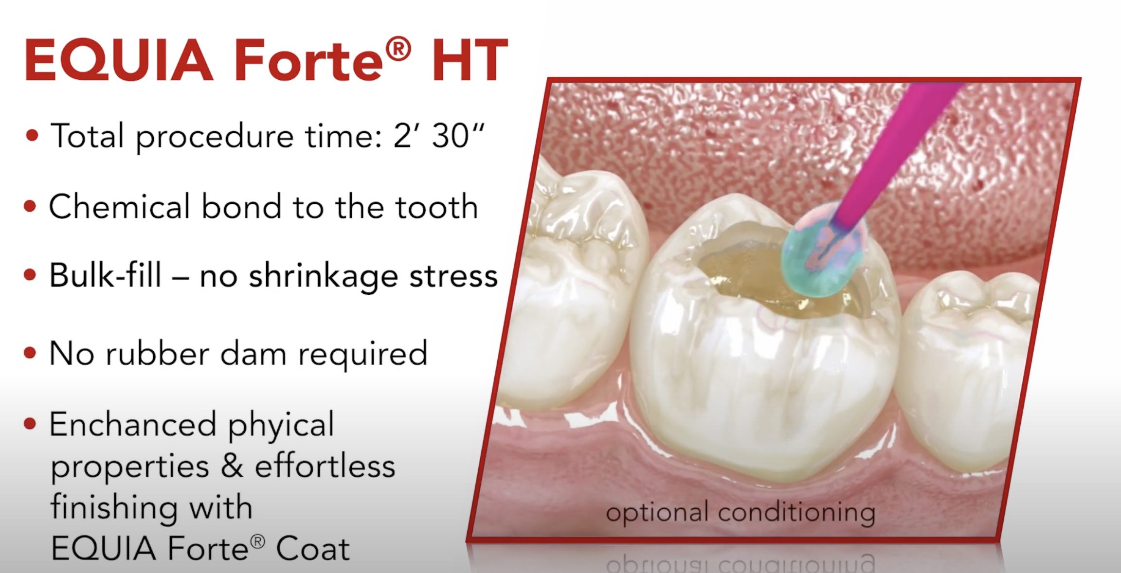 efht-vid-tech-thumb EQUIA Forte® HT - Restoration Guide